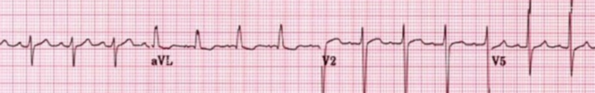 ECG elearning banner